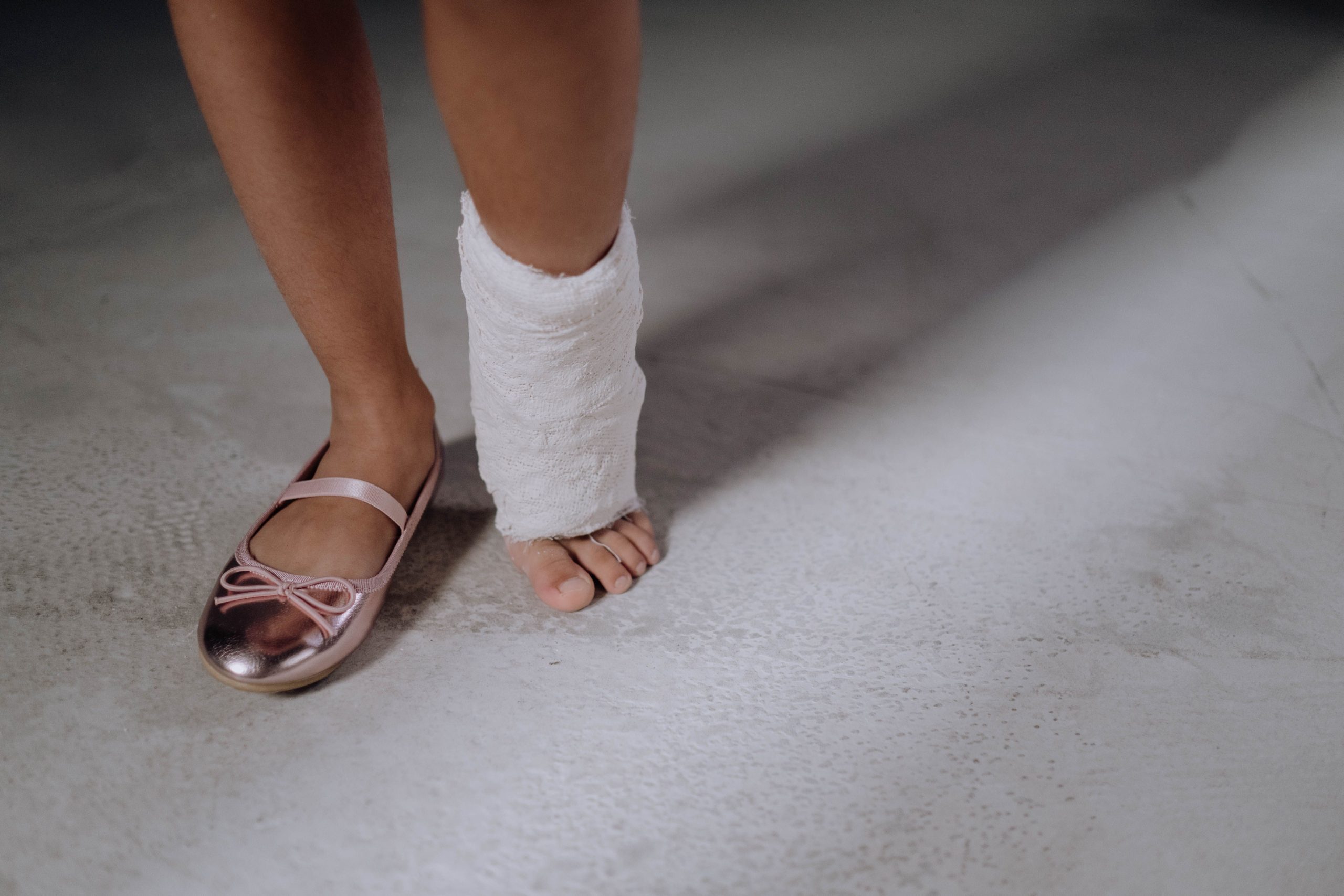Gipsverband, Beinbruch